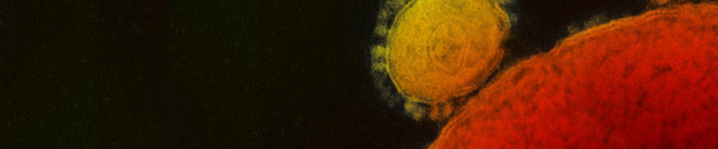 Coronavirus microbes, MERS-CoV-NIAID, MERS, CoV, NIAID, yellow, orange Grainy, large red and yellow spheres of Middle East respiratory syndrome coronavirus.