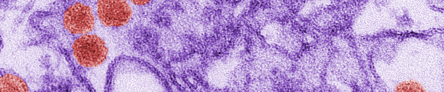 Purple tendrils and red spheres of the Zika virus.