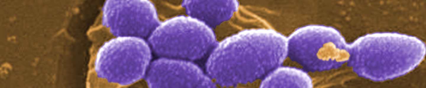 Purple spheres of Enterococcus faecalis bacteria.