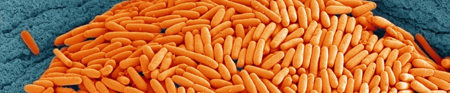 Baby carrot-like pile of Clostridium difficile bacteria.