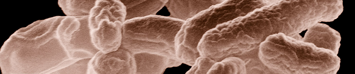 Brown and white, rod-shaped Escherichia coli bacteria cluster.