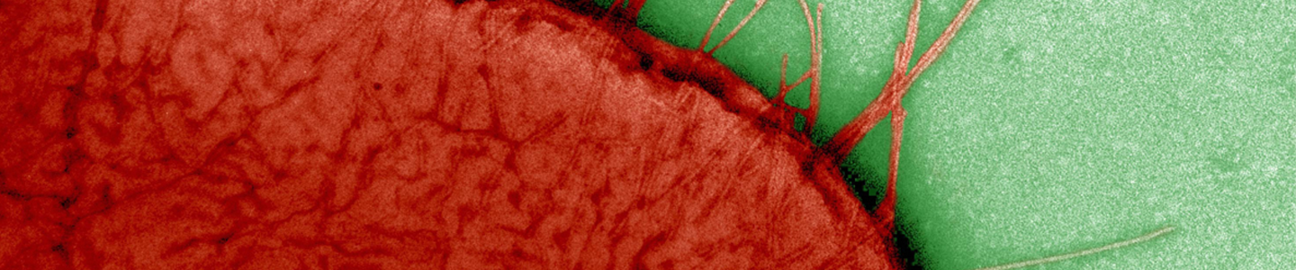 Closeup of red Escherichia coli bacteria.