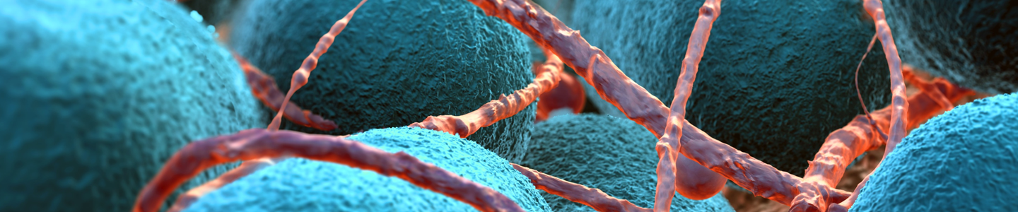 Closeup of teal-blue Escherichia coli balls covered in red yard-like strings.