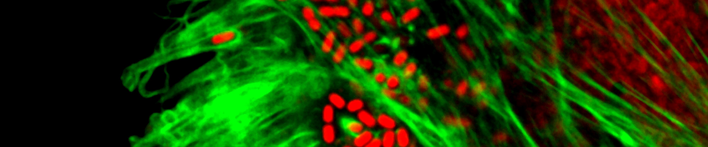 Red, rod-shaped Shigella bacteria in a green web.