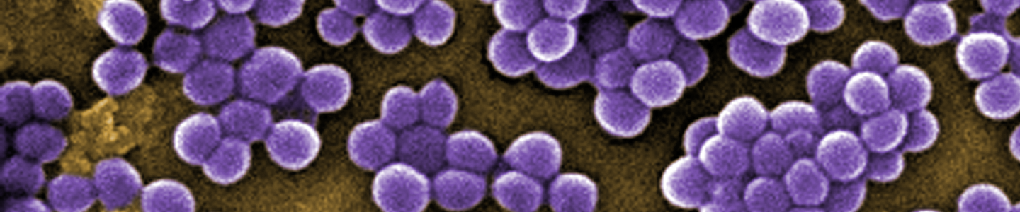 Cluster of purple, grape-shaped methicillin-resistant Staphylococcus aureus bacteria.
