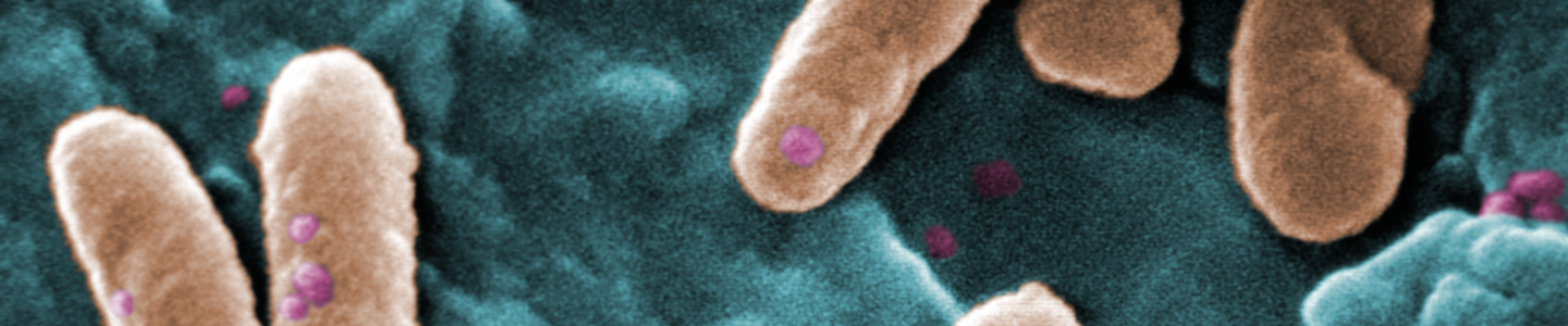 Brown, rod-shaped Pseudomonas aeruginosa bacteria.