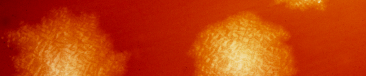 Orange-yellow, textured spheres of Clostridium difficile bacteria.