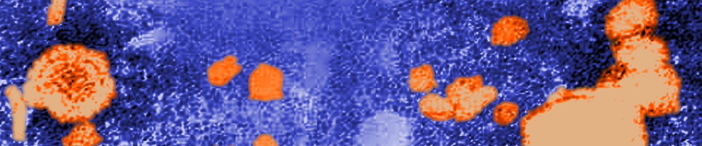 Grainy, blue and orange Hepatitis virus.