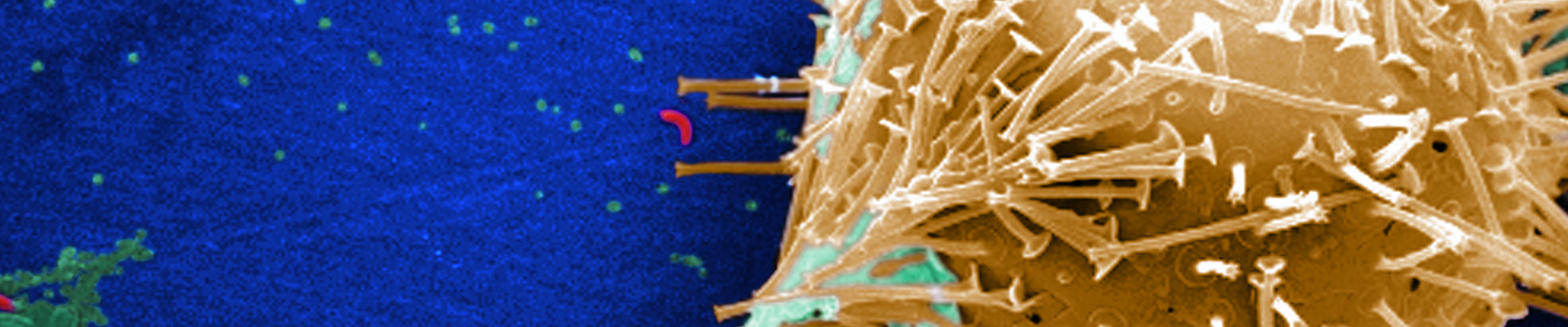 Thin, green stem attached to a gold ball of spikes making up an untreated water specimen.