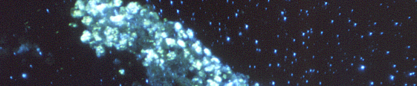 Blue fluorescent staining of Histoplasma capsulatum fungus.
