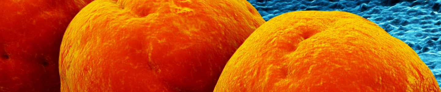 Orange balls of Streptococcus bacteria.