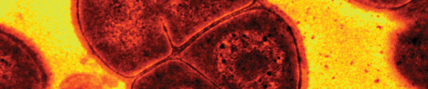 Grainy red and black Deinococcus radiodurans extremophilic bacterium.