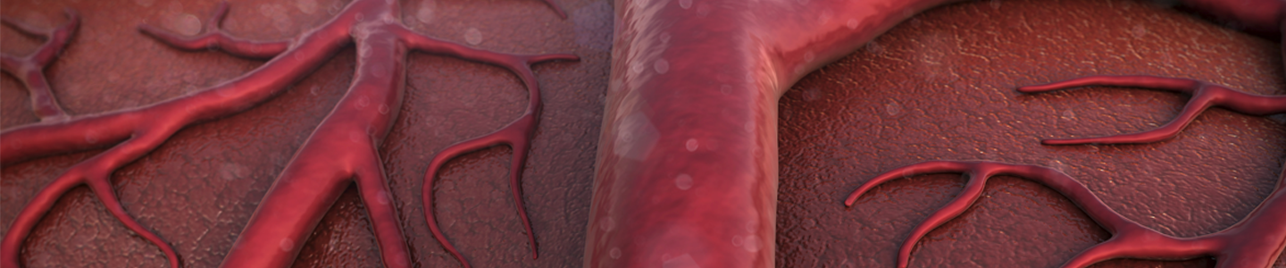 Closeup of thick red blood vessels.