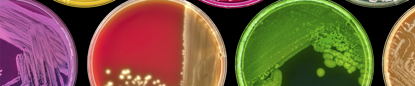 Petri dishes filled with bright-colored cells and media in different line and spot patterns.