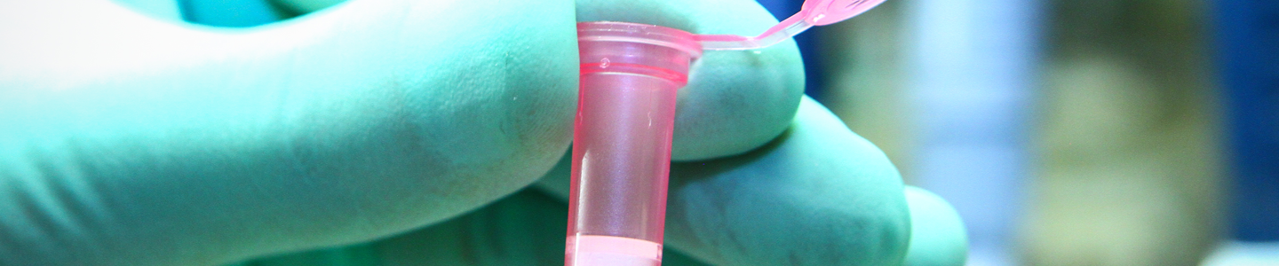 Gloved hand holding small, plastic, pink vial with flip-top lid open.