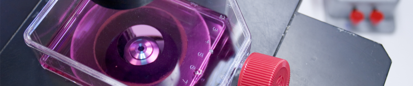 Culture flask containing purple media on stage of microscope.