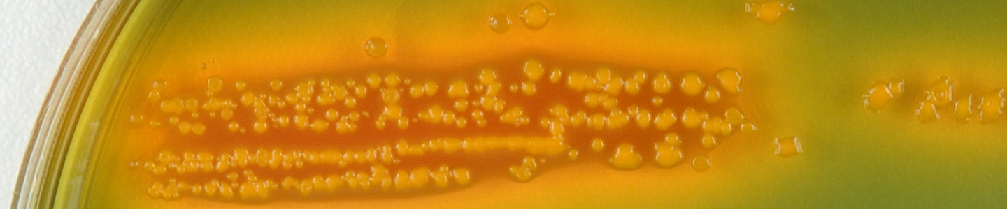 Petri dish culture of E coli bacteria.