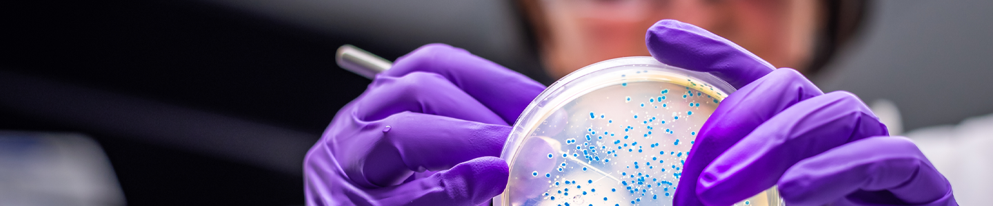 Underside view of petri dish with blue bacteria being held by scientist wearing gloves.