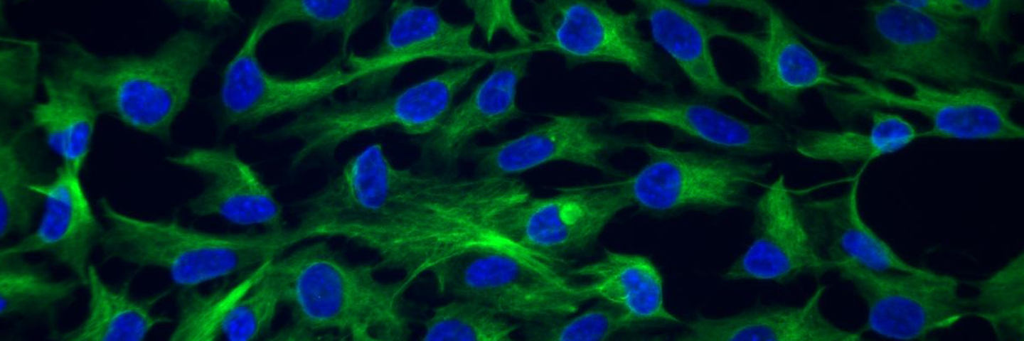 Green and blue epithelial htert cells.