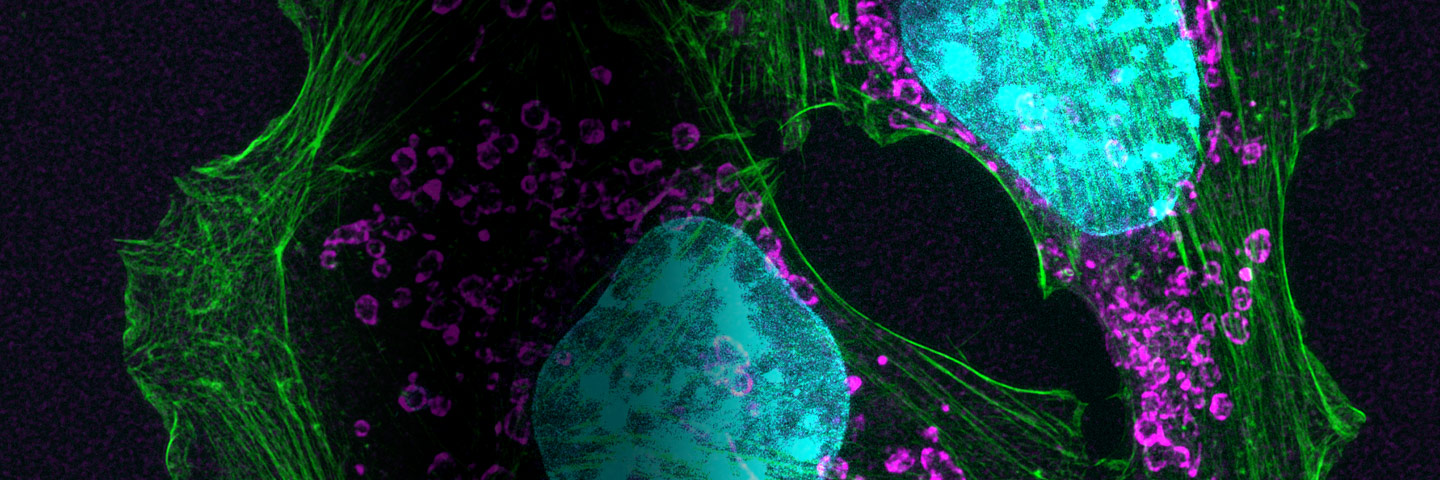 Purple and green top mouse skin cancer cells.