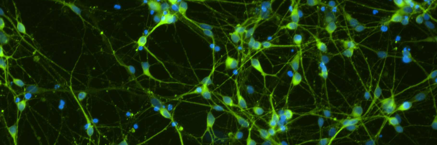 Green and blue dopaminergic Diff Tuj1 DAPI cells.