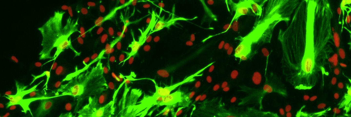 Green and red astrocyte GFAP neural progenitor cells.