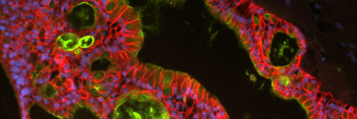 Green, pink and blue organoid cells.