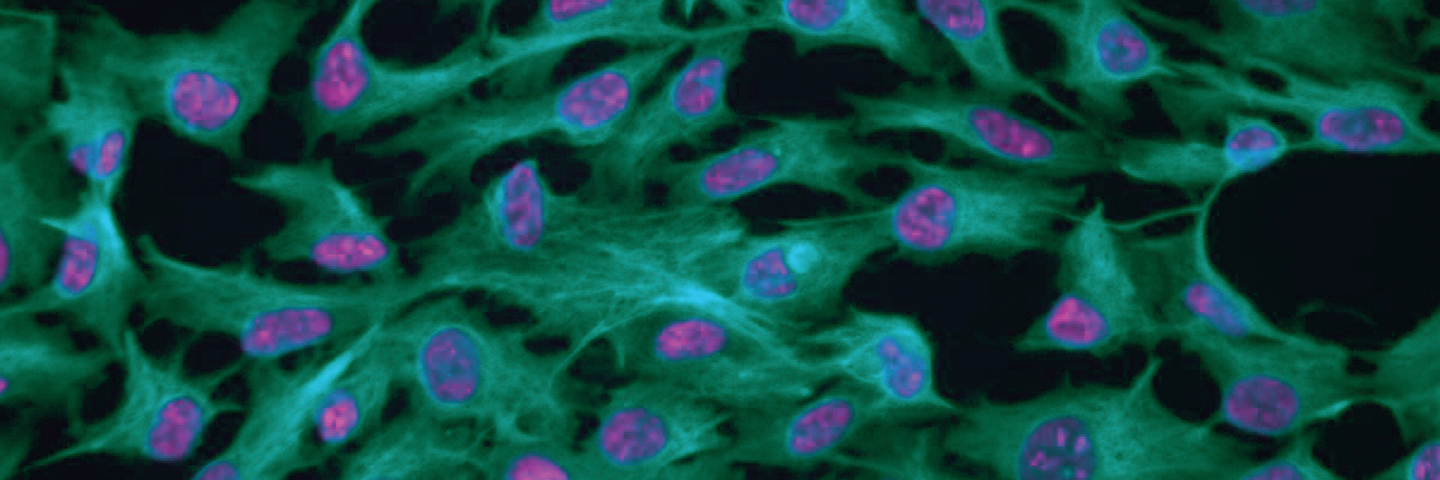 Green and purple Cyto-01 retinal epithelial cells.