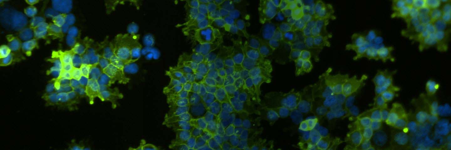 Green and blue human embryonic kidney cells.