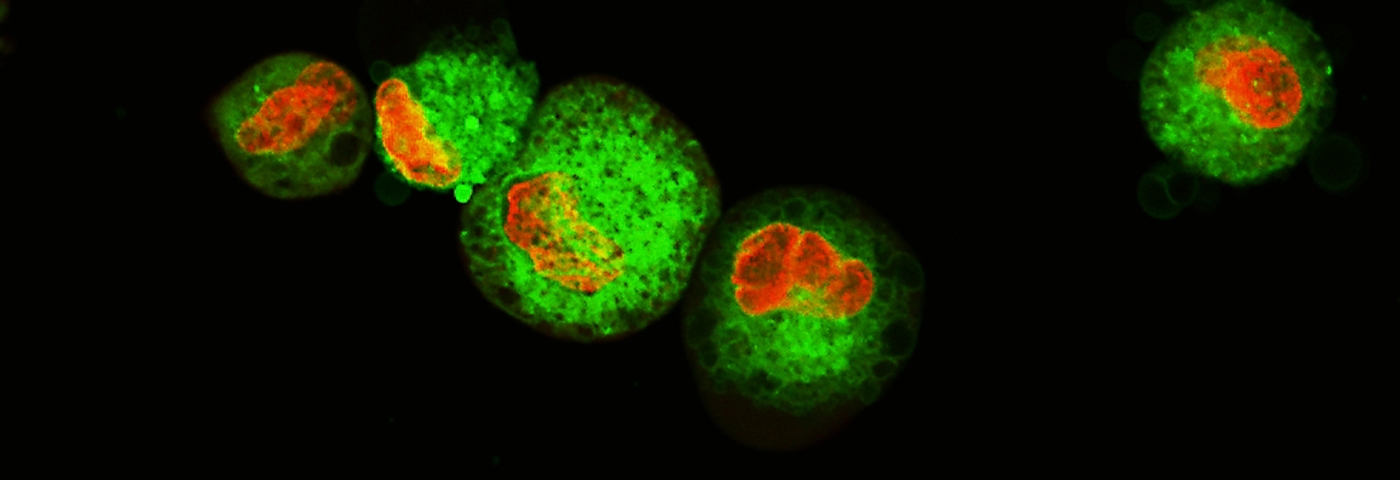 Luciferase Reporter Cancer Cell Lines Facilitate CAR-T Development | ATCC