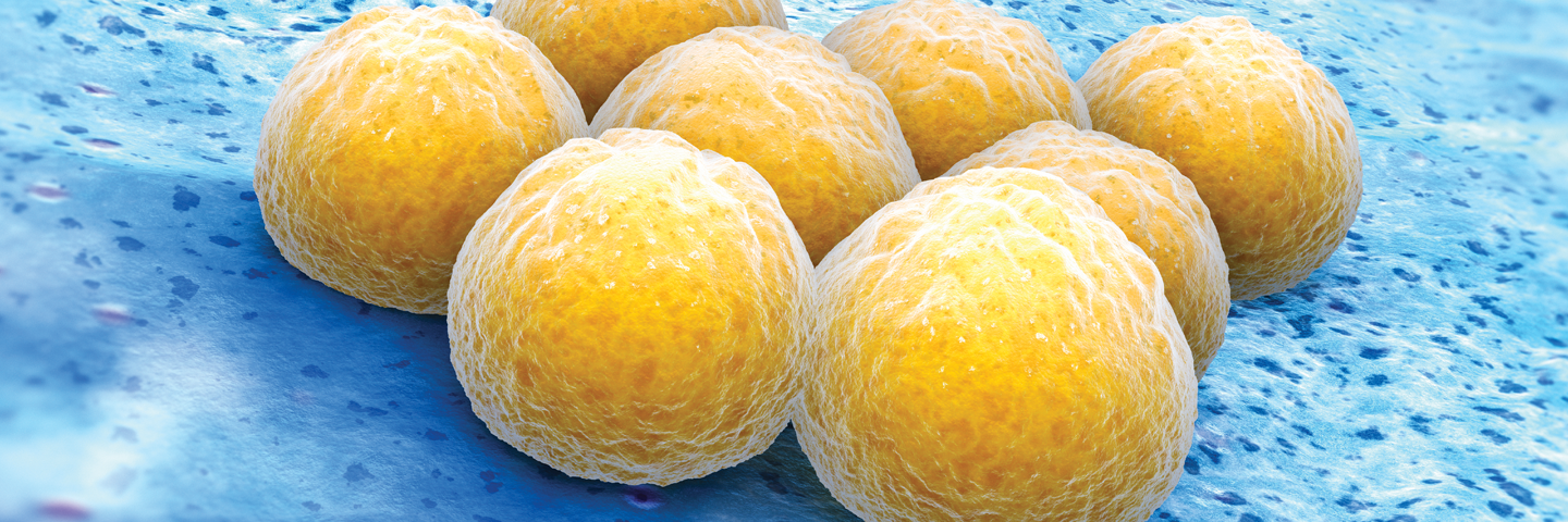 Yellow balls of Staphylococcus, aureus bacteria.