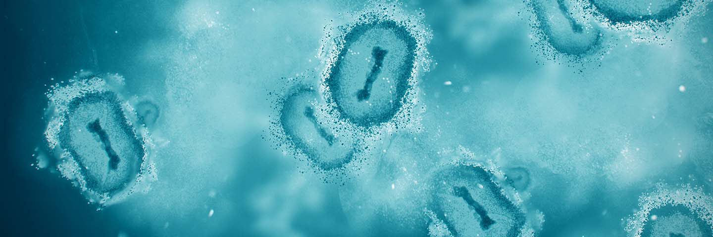 Monkeypox virus