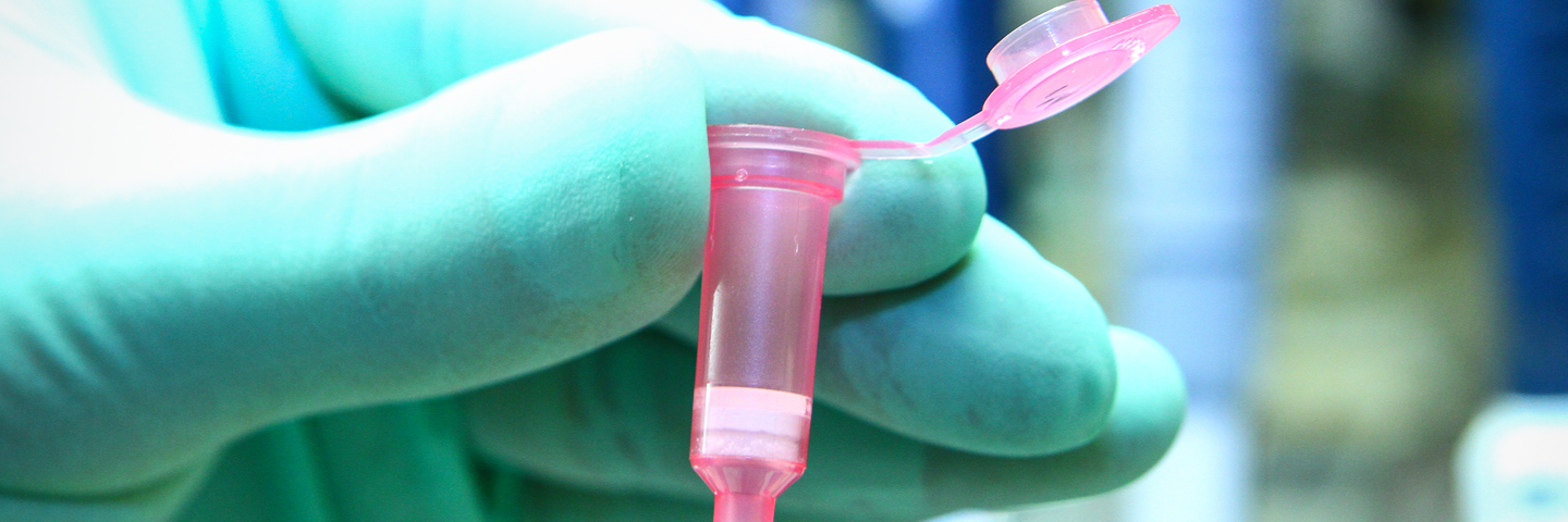 Gloved hand holding small, plastic, pink vial with flip-top lid open.