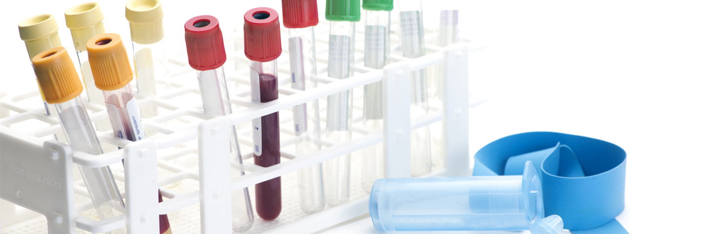 Test tubes with various colored caps in a stand, 2 of the test tubes filled with blood; syringe, tourniquet, and vial nearby.