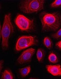Spherical, fluorescent pink and purple bronchial epithelial cells.