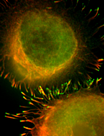 Orange and green K-562 bone marrow cells.