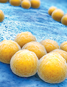 Yellow balls of Staphylococcus, aureus bacteria.