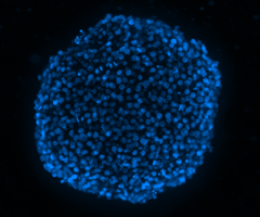 A bright-blue, fluorescent, DAPI stain sphere with a black background.