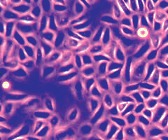 Cluster of small, fluorescent pink and black primary keratinocyte cells.