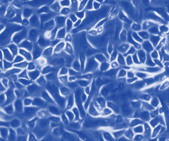 Cluster of small, fluorescent orange, blue, and white primary small airway epithelial cells.