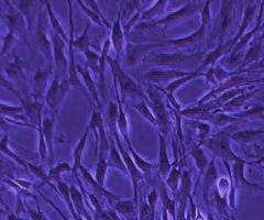 Connecting, long, thin, fluorescent purple, umbilical cord mesenchymal stem cells.