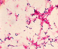 S. pneumo from blood bacteria.