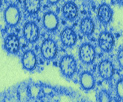 Small, round, and blue H1N1 flu virus.