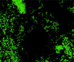Green e-coli cells.