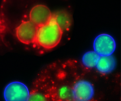 Greena and red yeast with macrophage cells.