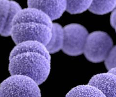 Strings of purple balls of Streptococcus pyogenes bacteria. 