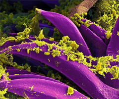 Purple, banana-shaped Yersinia pestis bacteria with yellow-green growths.