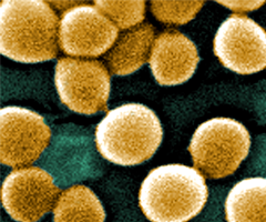 Yellow spheres of methicillin-resistant Staphylococcus aureus clustered together.