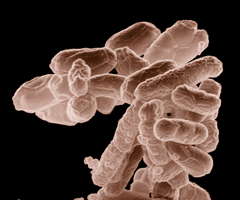 Brown and white, rod-shaped Escherichia coli bacteria cluster.