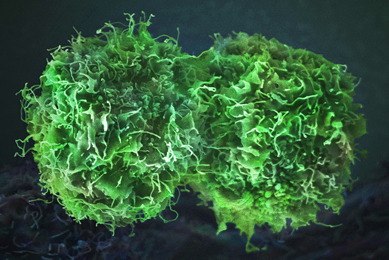 Round, green, lettuce-like skin cancer cells.